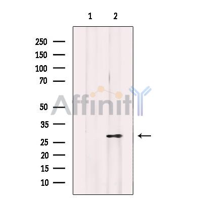 Mast Cell Chymase Antibody - Western blot analysis of extracts from MCF-7 cells, using Mast Cell Chymase Antibody.