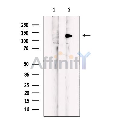 MLXIP Antibody - Western blot analysis of extracts from K-562 cells, using MLXIP Antibody.