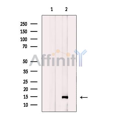 NA14 Antibody - Western blot analysis of extracts from human testis tissue, using NA14 Antibody.