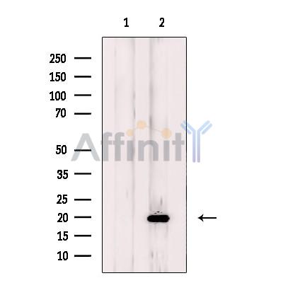 NDUFB11 Antibody - Western blot analysis of extracts from HepG2 cells, using NDUFB11 Antibody.