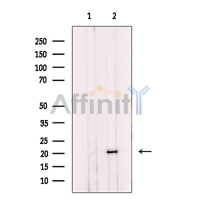 NDUFS7 Antibody - Western blot analysis of extracts from K-562 cells, using NDUFS7 Antibody.