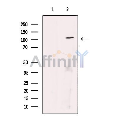 ZC3HAV1 Antibody - Western blot analysis of extracts from HeLa cells, using ZC3HAV1 Antibody.