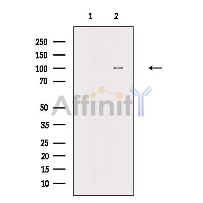 alpha Adaptin Antibody - Western blot analysis of extracts from HEK-293 cells, using alpha Adaptin Antibody.