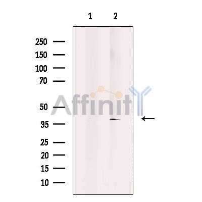 COQ9 Antibody - Western blot analysis of extracts from human liver tissue, using COQ9 Antibody.
