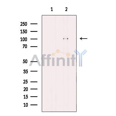 CTNNA3 Antibody - Western blot analysis of extracts from HEK-293, using CTNNA3 Antibody.