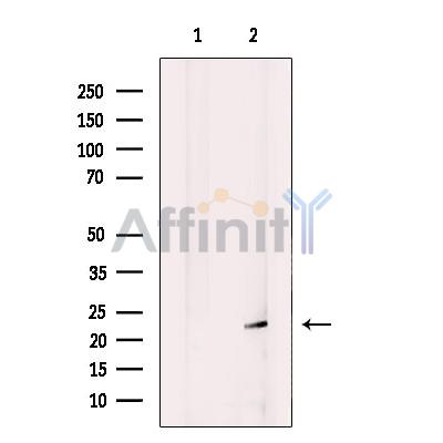 CYPC Antibody - Western blot analysis of extracts from HEK-293 cells, using CYPC Antibody.