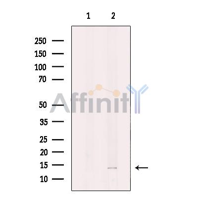 DNAJC19 Antibody - Western blot analysis of extracts from human lung tissue, using DNAJC19 Antibody.