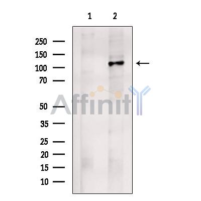 Drebrin Antibody - Western blot analysis of extracts from B16F10 cells, using Drebrin Antibody.
