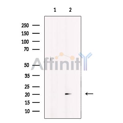 GREM2 Antibody - Western blot analysis of extracts from mouse kidney, using GREM2 Antibody.