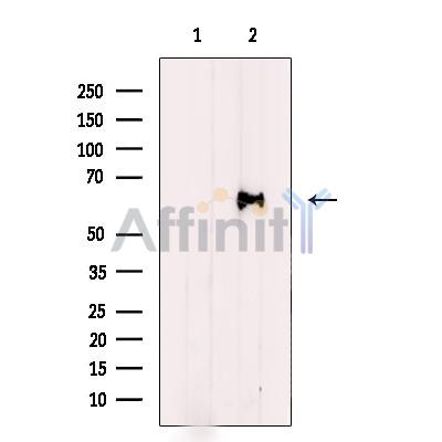 HPSE Antibody - Western blot analysis of extracts from Jurkat cells, using HPSE Antibody.
