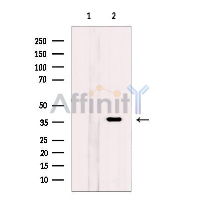 KCTD12 Antibody - Western blot analysis of extracts from MCF-7 cells, using KCTD12 Antibody.