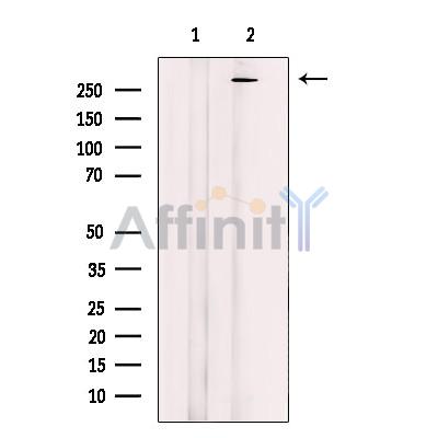 MAP1B Antibody - Western blot analysis of extracts from Human brain, using MAP1B Antibody.