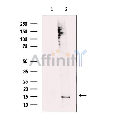 MRFAP1 Antibody - Western blot analysis of extracts from Jurkat cells, using MRFAP1 Antibody.