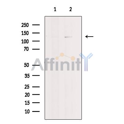 p107 Antibody - Western blot analysis of extracts from COLO320 cells, using p107 Antibody.