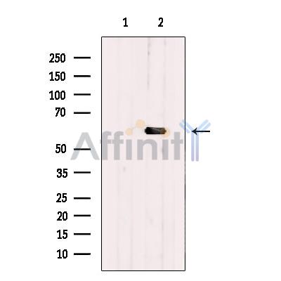 PHF17 Antibody - Western blot analysis of extracts from HEK-293 cells, using PHF17 Antibody.