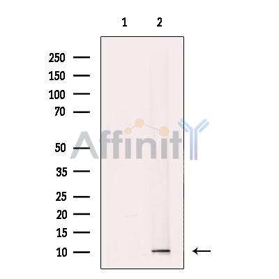 TIMM9 Antibody - Western blot analysis of extracts from mouse liver tissue, using TIMM9 Antibody.