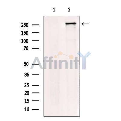 USP9X Antibody - Western blot analysis of extracts from HeLa, using USP9X Antibody.