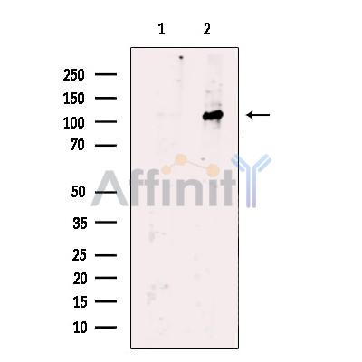 VPS11 Antibody - Western blot analysis of extracts from HEK-293 cells, using VPS11 Antibody.