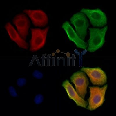 MCCC2 Antibody - DF12655 staining Hela cells by IF/ICC.