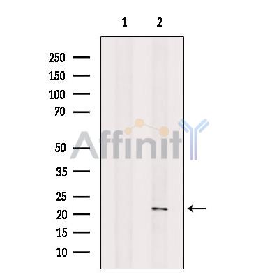NCS1 Antibody - Western blot analysis of extracts from K562, using NCS1 Antibody.