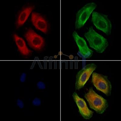 SPTLC1 Antibody - DF12752 staining Hela cells by IF/ICC.