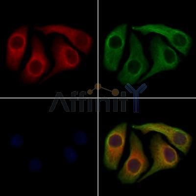TXNDC5 Antibody - DF12787 staining Hela cells by IF/ICC.