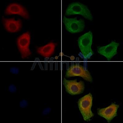 VPS41 Antibody - DF12795 staining Hela cells by IF/ICC.