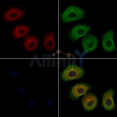 ARHGAP10 Antibody - DF12830 staining Hela cells by IF/ICC.