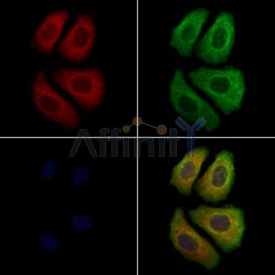 ARHGAP15 Antibody - DF12831 staining Hela cells by IF/ICC.