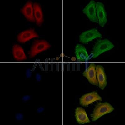 ARL4C Antibody - DF12833 staining Hela cells by IF/ICC.