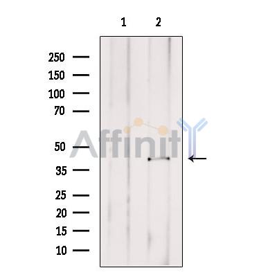 GJB6 Antibody - Western blot analysis of extracts from Rat  brain, using GJB6 Antibody.
