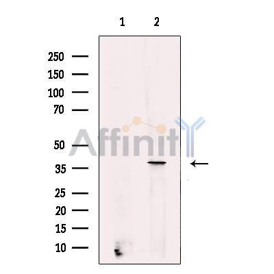Stra8 Antibody - Western blot analysis on Mouse testis tissue using STRA8 antibody.