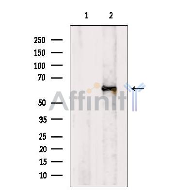 Retinoid X Receptor beta Antibody - Western blot analysis of extracts from HepG2 cells, using Retinoid X Receptor beta  Antibody.