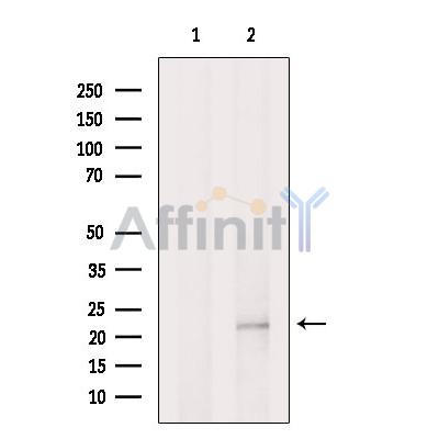 SCXA Antibody - Western blot analysis of extracts from Pc12, using SCXA Antibody.