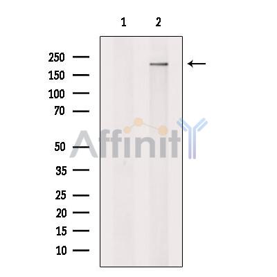 Spt6 Antibody - Western blot analysis of extracts from K562, using Spt6 Antibody.