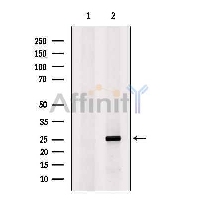 Nociceptin Antibody - Western blot analysis of extracts from Myeloma cells, using Nociceptin Antibody.