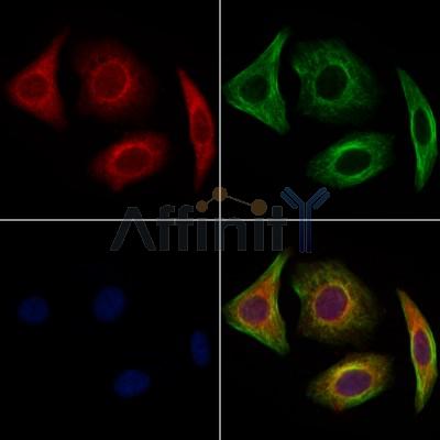 Golgin 97 Antibody - DF13403 staining Hela cells by IF/ICC.