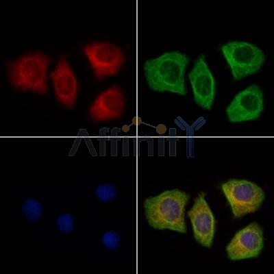Surfactant Protein A Antibody - DF13404 staining Hela cells by IF/ICC.