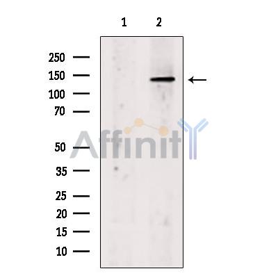 hFANCI Antibody - Western blot analysis of extracts from EC304 cells, using FANCI Antibody.