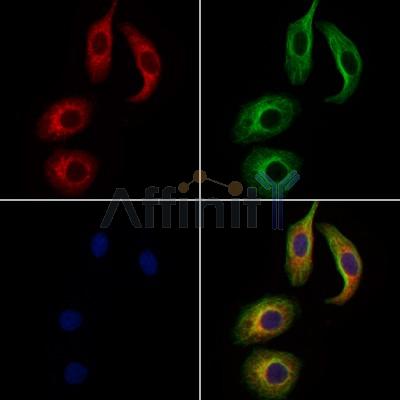 Wnt3 Antibody - DF13430 staining Hela cells by IF/ICC.