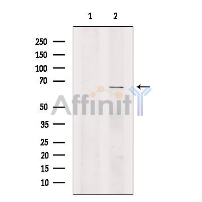 LYRIC Antibody - Western blot analysis of extracts from B16F10 cells, using LYRIC Antibody.