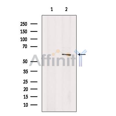 Frizzled 4 Antibody - Western blot analysis of extracts from B16F10 cells, using Frizzled 4 Antibody.
