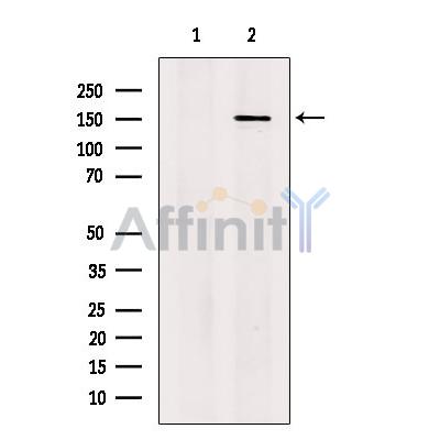 SCC112 Antibody - Western blot analysis of extracts from B16F10 cells, using SCC112 Antibody.