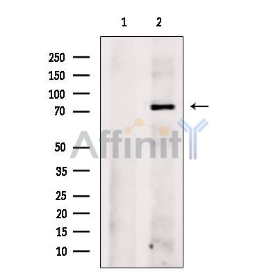 CBX4 Antibody - Western blot analysis of extracts from VERO cells, using CBX4 Antibody.