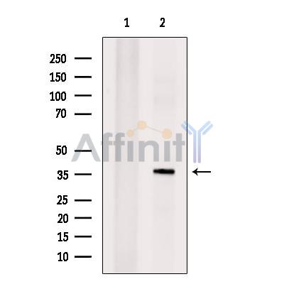 TCF21 Antibody - Western blot analysis of extracts from EC304 cells, using TCF21  Antibody.