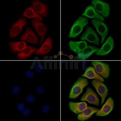 KCNK10 Antibody - DF13480 staining Hela cells by IF/ICC.