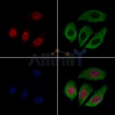 CASC5 Antibody - DF13491 staining Hela cells by IF/ICC.