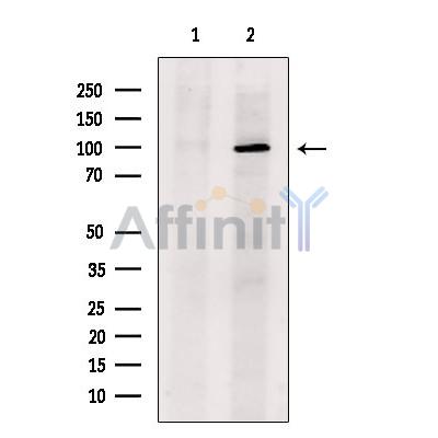 Sulfatase 2 Antibody - Western blot analysis of extracts from VERO cells, using Sulfatase 2 Antibody.