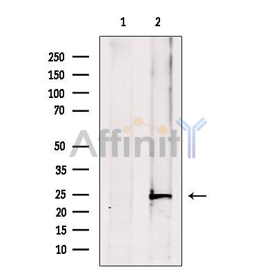 ATP6V1E1 Antibody - Western blot analysis of extracts from Mouse  spleen, using ATP6V1E1 Antibody.