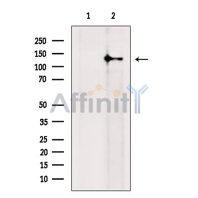 RASGRF2 Antibody - Western blot analysis of extracts from Mouse  brain, using RASGRF2 Antibody.